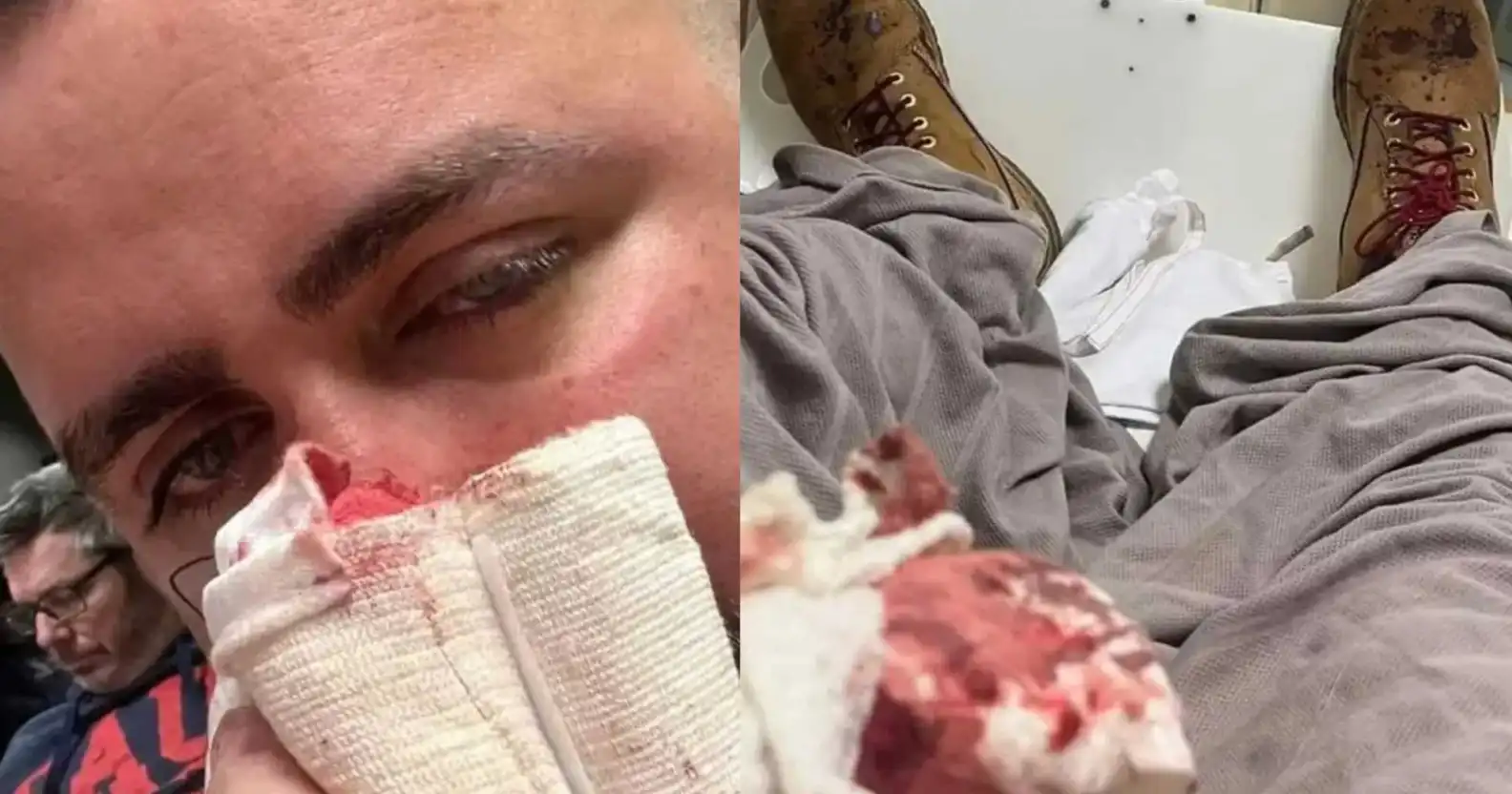 Couple gay attaqué dans une agression homophobe : un crime haineux brutal choque l’Australie